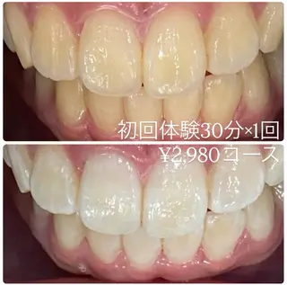 PLATINUM Beauty 横浜店所属・ホワイトニングルーム 横浜店のその他イメージ