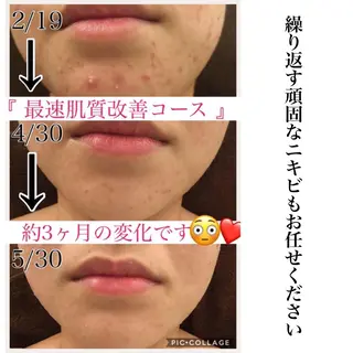 ミディアム カラー パーマ ヘアアレンジ メンズ キッズ ネイル マツエク・マツパ ニキビ・肌質改善専門 ♡人生が変わるサロンのエステ・リラクイメージ