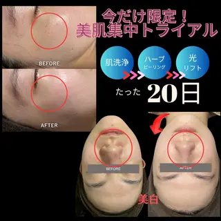 Adam 上半身美人のエステ・リラクイメージ