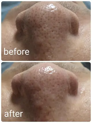 メンズ 🌿emirai SEN🌿のエステ・リラクイメージ