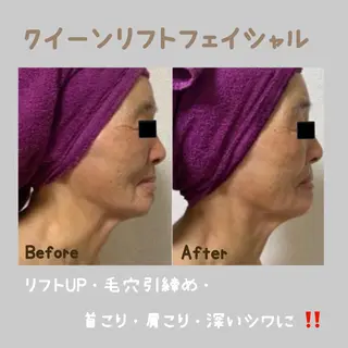 ヴィーナス ビューティーのエステ・リラクイメージ