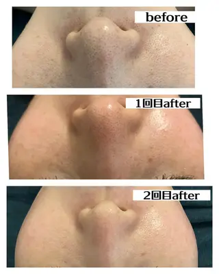 Dione湘南藤沢店 ×LUANA 齋藤のエステ・リラクイメージ