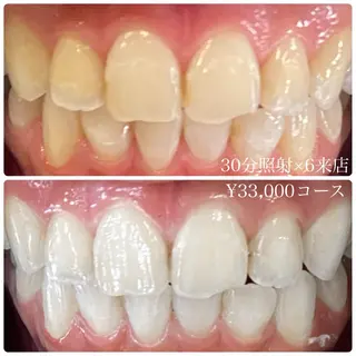 メンズ ホワイトニングルーム　川崎店所属・ホワイトニング ルーム　川崎店のその他イメージ