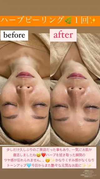 Salon de Lino 御器所のエステ・リラクイメージ