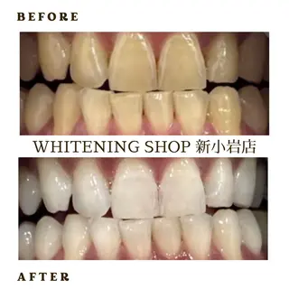 メンズ ホワイトニング ショップ新小岩店のその他イメージ