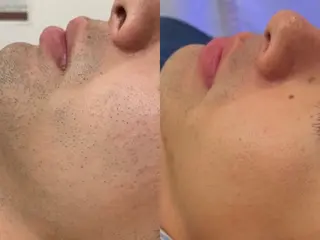 脱毛×アイラッシュCeriseLaLa所属・まつげ＆アイブロウ スリーズララ🍒のマツエク・マツパデザイン