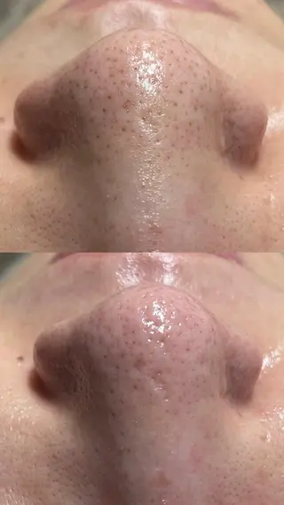 Lilyboo 池袋のエステ・リラクイメージ