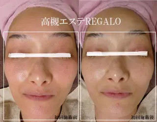 REGALO所属・矢野 さやかのエステ・リラクイメージ