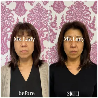 毛穴レス ハーブ＆ ワックス脱毛×光脱毛のエステ・リラクイメージ