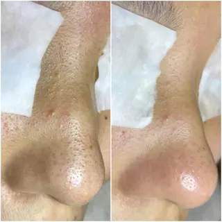 毛穴肌育専門店 リールのエステ・リラクイメージ