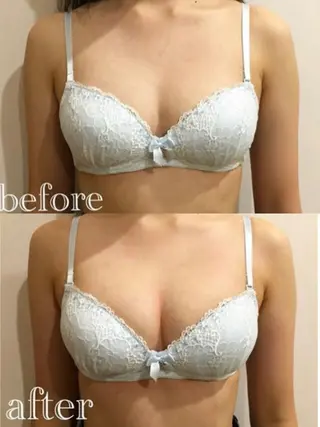 Mellow所属・ブライダル専門バスト サロンMellowのエステ・リラクイメージ