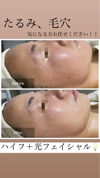 Private  Beauty Salon " MEILI"所属・meili salonのエステ・リラクイメージ