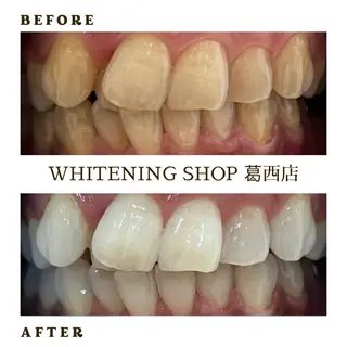 メンズ ホワイトニング ショップ葛西店のその他イメージ