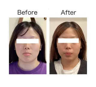 小顔サロンSharp …腸調整よもぎ蒸しのエステ・リラクイメージ