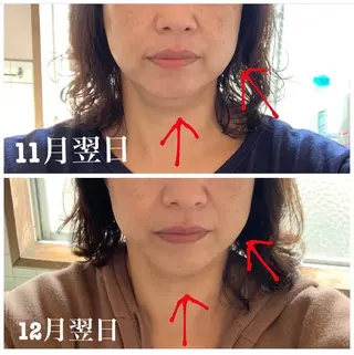 小顔と ヘッドスパのお店のエステ・リラクイメージ