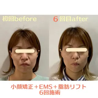 最速小顔・肌質管理 ❣️エスポワールのエステ・リラクイメージ