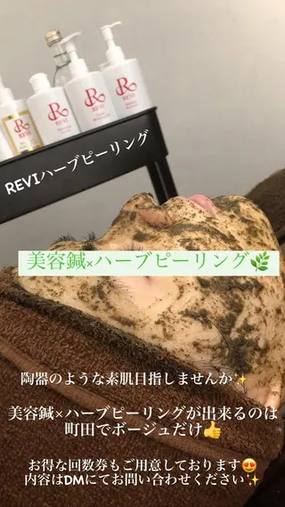 美容鍼灸整体サロンBeauJu所属・小顔矯/美容鍼/鍼灸 BeauJuのその他イメージ