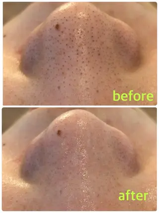 mana 東梅田店のエステ・リラクイメージ