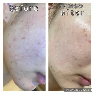 ニキビ改善専門店 d'Albaのエステ・リラクイメージ