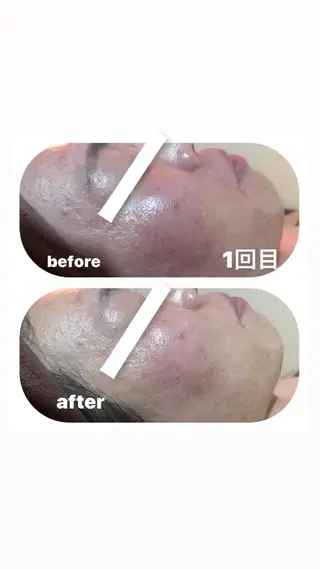 【足圧】鬼👹リンパ 身体整うサロンのエステ・リラクイメージ