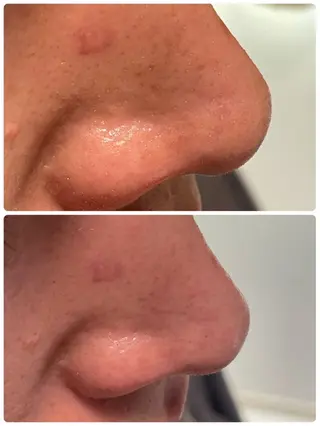 NARIS BEAUTY STATION　デ・アイム 京橋所属・ニキビ跡/毛穴/ 肌質改善/北村ももこのエステ・リラクイメージ