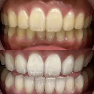 LBSホワイトニング 銀座店💎スタッフ峯のその他イメージ