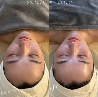 うなじ脱毛/美肌脱毛 LABELのエステ・リラクイメージ