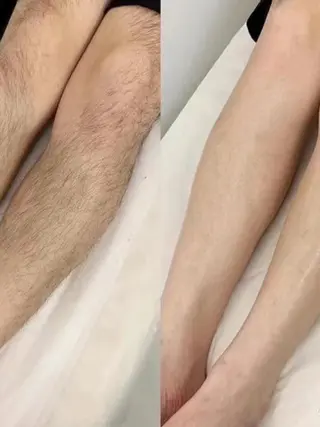 痩身・小顔・脱毛・ オイル&Amourのエステ・リラクイメージ