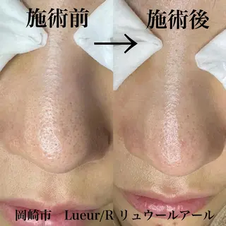 大久保 里奈のエステ・リラクイメージ