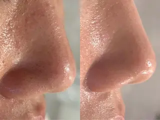 【都度払い脱毛 美肌脱毛】馬車道店のエステ・リラクイメージ