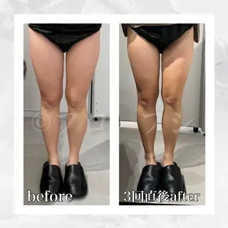 部分痩せ♥️小顔専門 MIKUのエステ・リラクイメージ