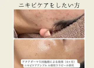 ぷるる 練馬のエステ・リラクイメージ