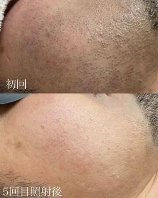 メンズ EARTH coiffure beaute 小山店所属・EARTH 小山店 shimaのエステ・リラクイメージ