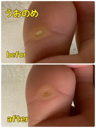 巻き爪&フットケア レクーラのその他イメージ