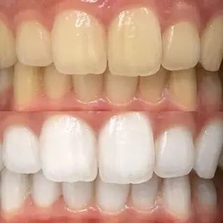 歯科提携セルフダック 宇都宮駒生店のエステ・リラクイメージ