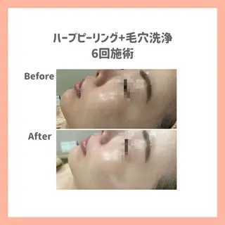 ハーブピーリング専門 muro.のエステ・リラクイメージ