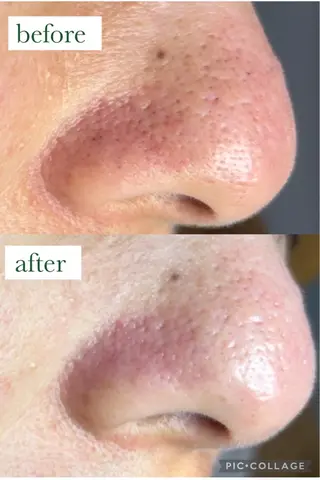 Frele Komiのエステ・リラクイメージ