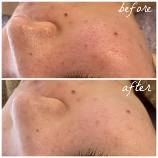 メンズ メナード岐阜市茜部 杉浦のエステ・リラクイメージ