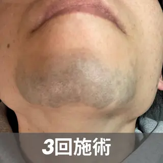 メンズ GLOW by MKのエステ・リラクイメージ