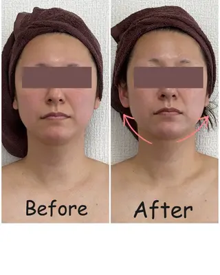 Eminy by  L★sのエステ・リラクイメージ