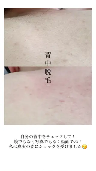 Hit. シュガーリング豊橋のエステ・リラクイメージ