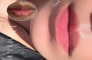 小顔/たるみ/黒ずみ除去専門サロン/SONA 大和西大寺店所属・【小顔専門看護師 サロンSONA】のエステ・リラクイメージ