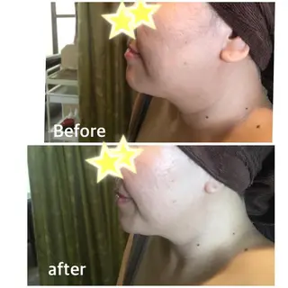 Crown  Jewel所属・CrownJewel クラウン ジュエルのエステ・リラクイメージ