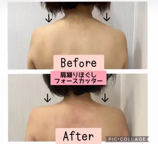 ブライダル痩身×脱毛 尼崎駅前サロンのエステ・リラクイメージ