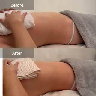 セミロング ハーブピーリング✨ 🌿最強痩身🔥のエステ・リラクイメージ