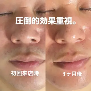 メンズ 脱毛サロンMIRUDA所属・脱毛サロン MIRUDAのエステ・リラクイメージ