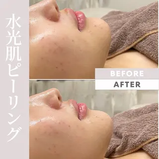 Purua beuty所属・月1肌管理 RINAのエステ・リラクイメージ