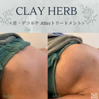 【剥離ありハーブピーリング専門エステ】cerisier BEAUTÉ 原宿所属・cerisier BEAUTÉのエステ・リラクイメージ