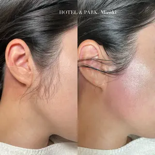 HOTEL&PARK . ワックス脱毛のエステ・リラクイメージ