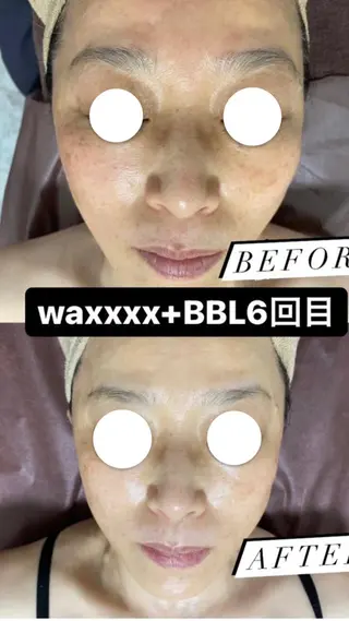 Epina 千葉店 【エピナ】のエステ・リラクイメージ